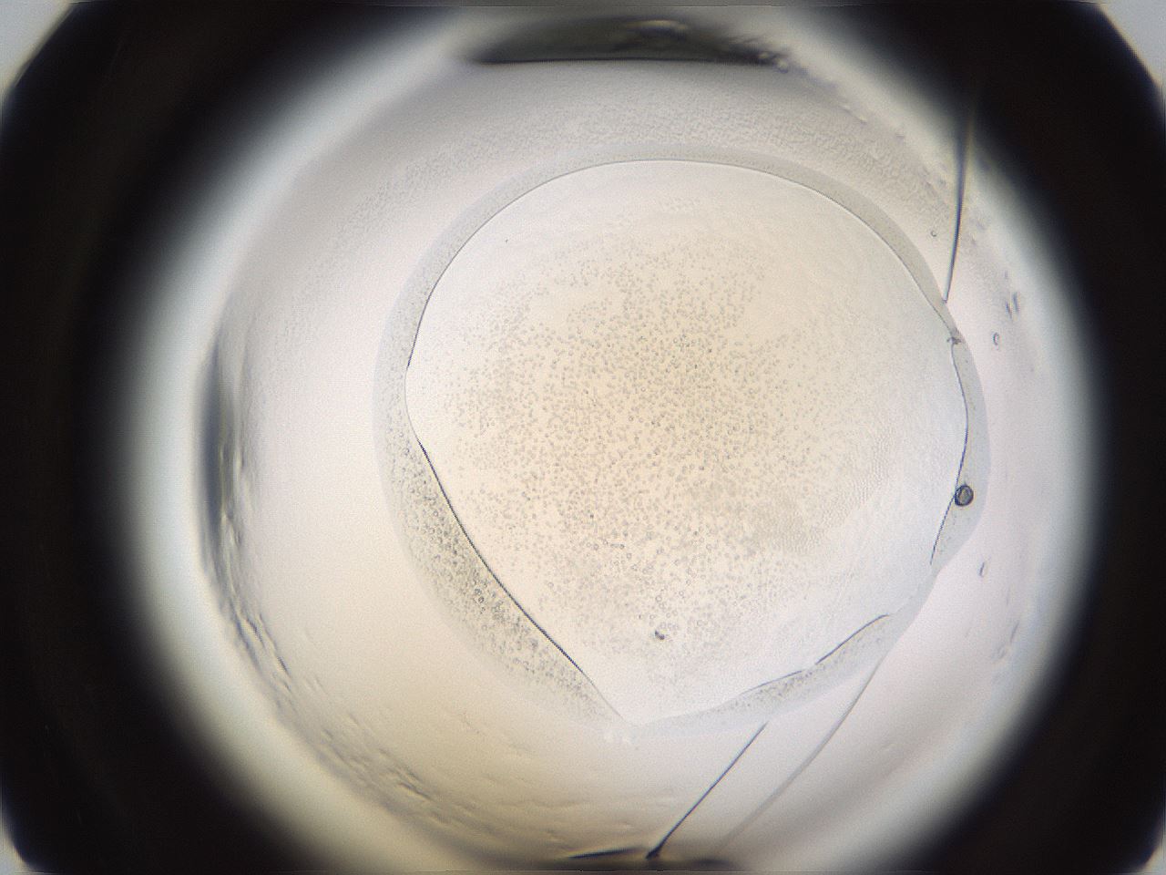 folderID594_plateID2594_batchID13187_wellNum18_profileID1_d1_r205405_ef.jpg