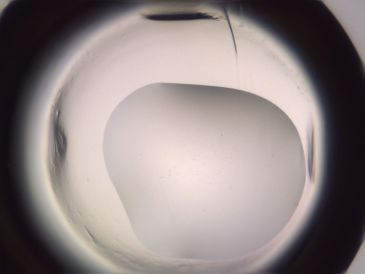folderID599_plateID2599_batchID13157_wellNum92_profileID1_d3_r198428_ef.jpg