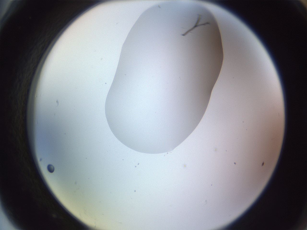 folderID604_plateID1604_batchID6727_wellNum78_profileID1_d2_r105935_ef.jpg