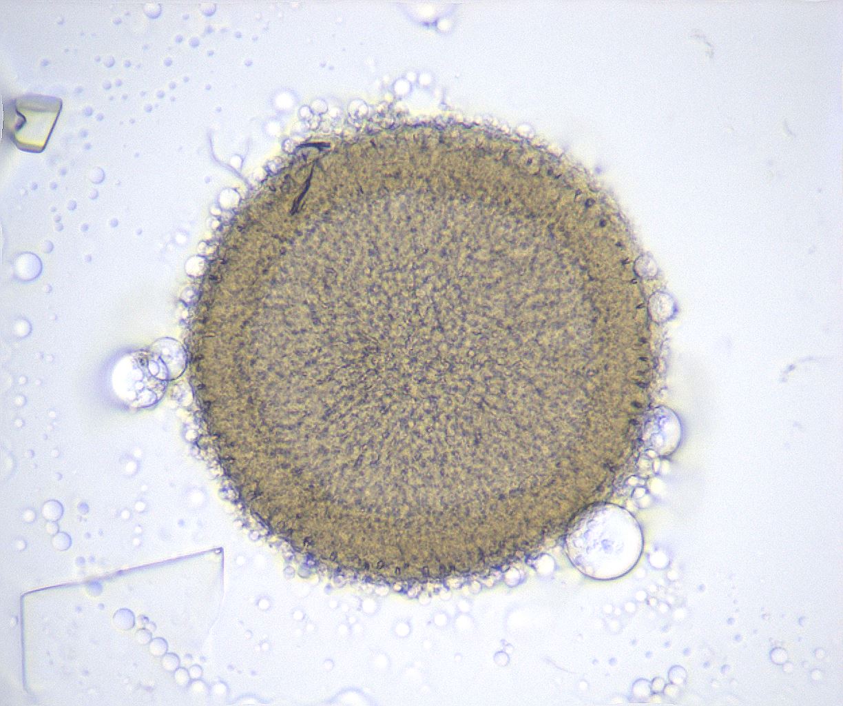 folderID357_plateID2357_batchID11083_wellNum64_profileID1_d1_r167713_ef.jpg