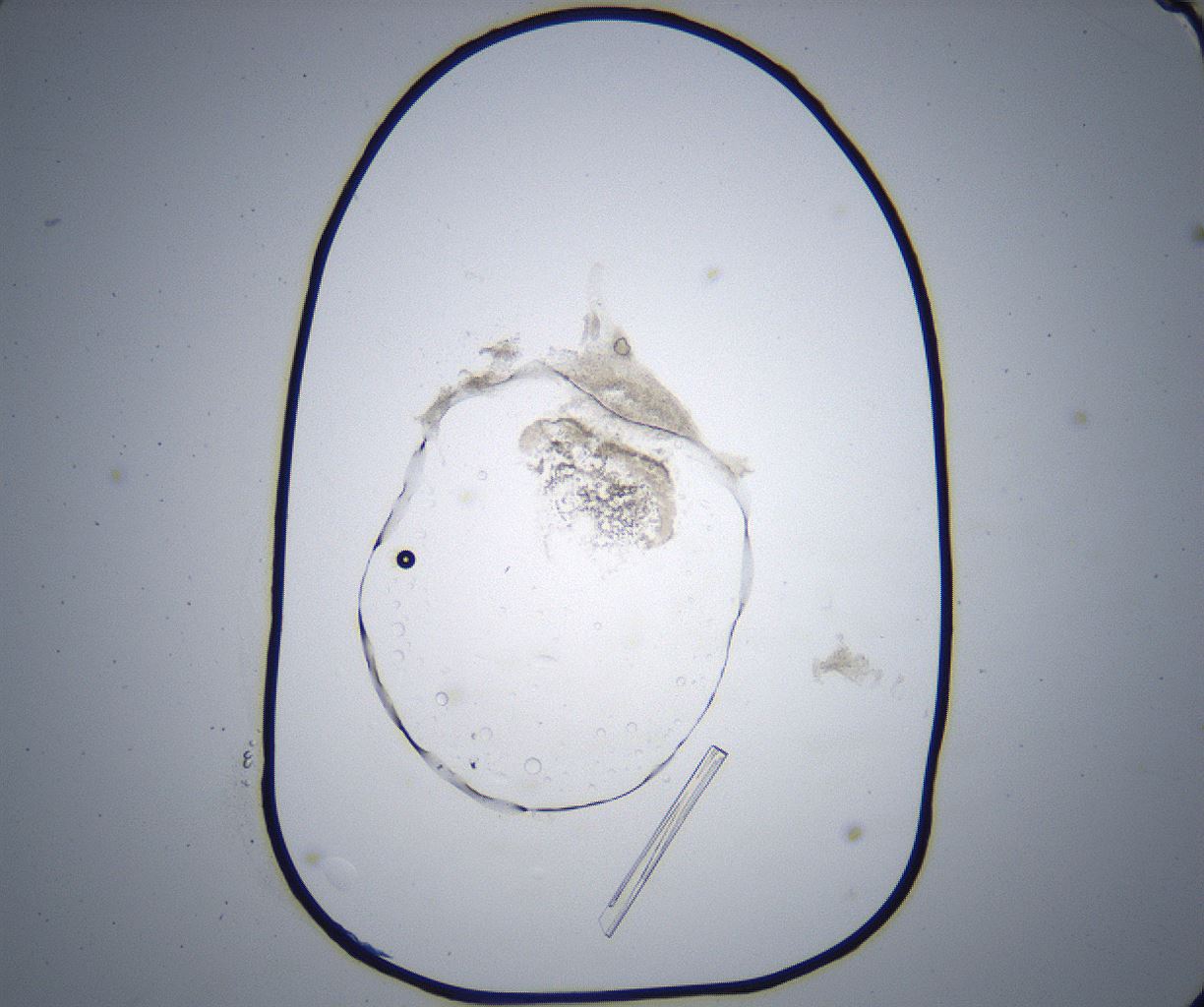 folderID364_plateID2364_batchID11089_wellNum76_profileID1_d1_r168697_ef.jpg