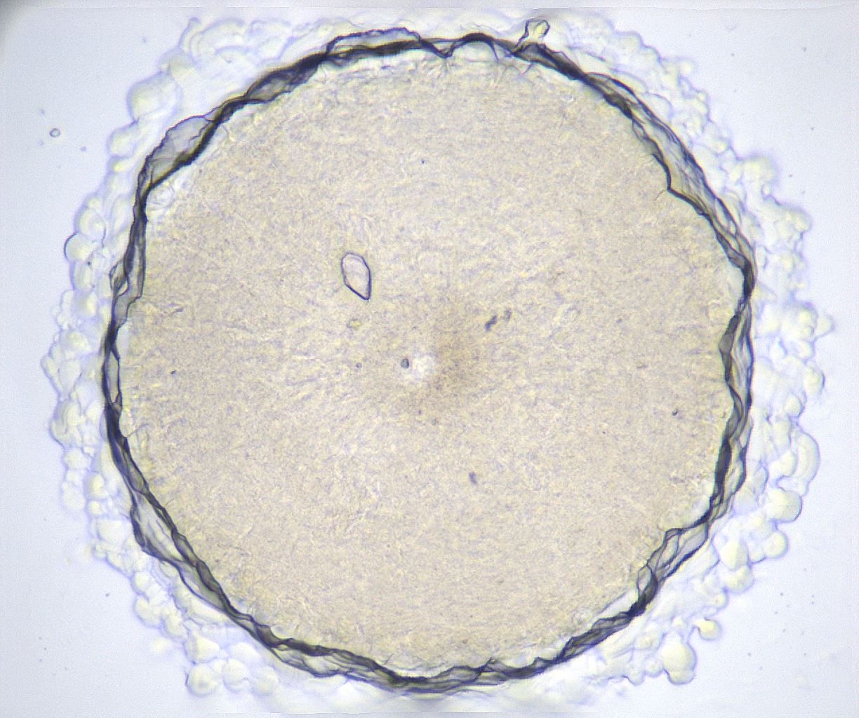 folderID369_plateID2369_batchID11114_wellNum56_profileID1_d1_r170577_ef.jpg
