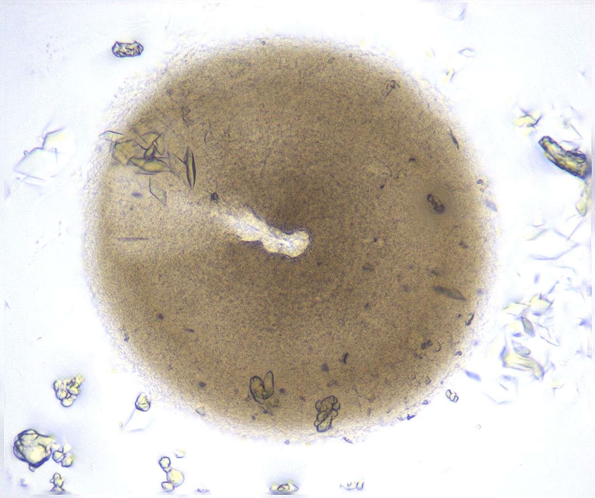 folderID370_plateID2370_batchID11110_wellNum62_profileID1_d1_r169821_ef.jpg