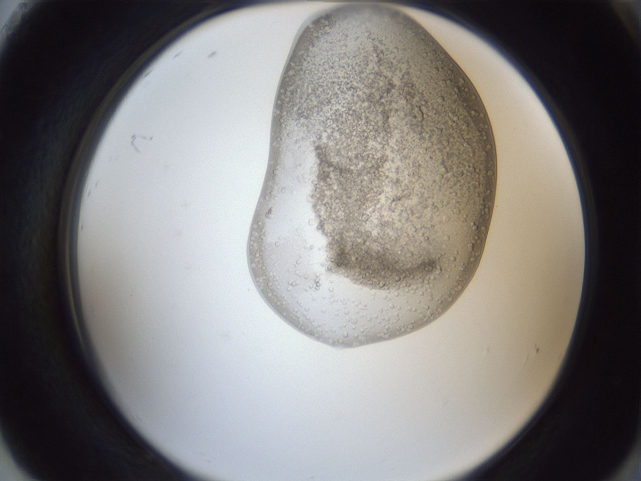 folderID161_plateID1161_batchID3209_wellNum92_profileID1_d2_r63382_ef.jpg