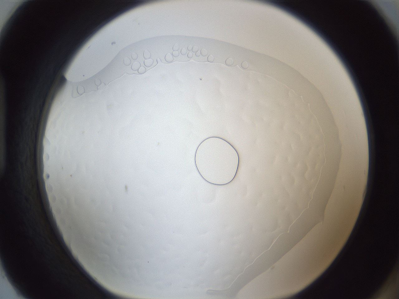 folderID167_plateID1167_batchID3123_wellNum93_profileID1_d1_r61655_ef.jpg
