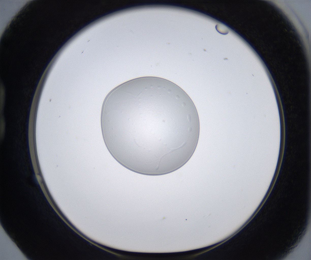 folderID305_plateID2305_batchID10850_wellNum17_profileID1_d1_r161246_ef.jpg