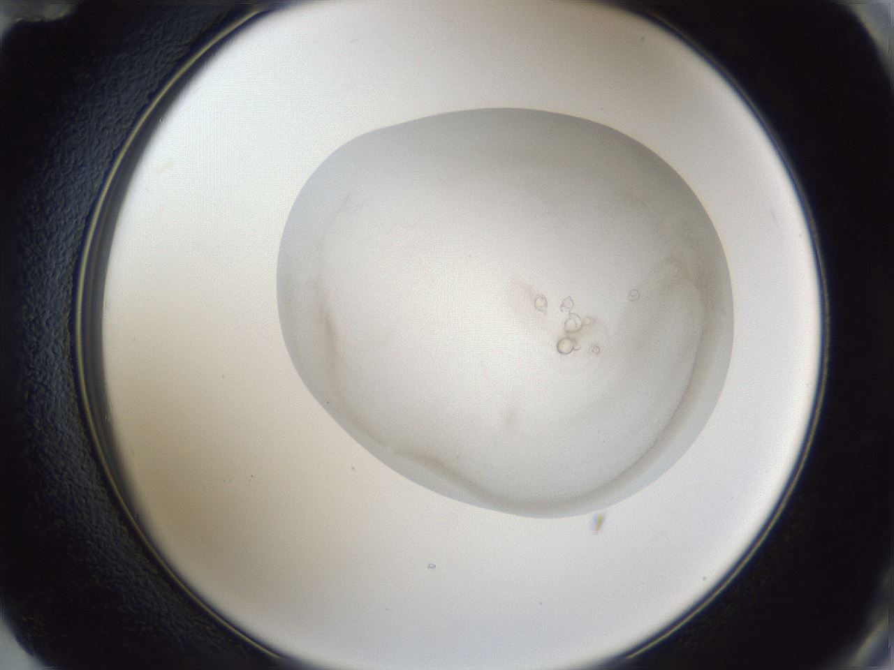 folderID32_plateID1032_batchID2002_wellNum72_profileID1_d2_r44659_ef.jpg