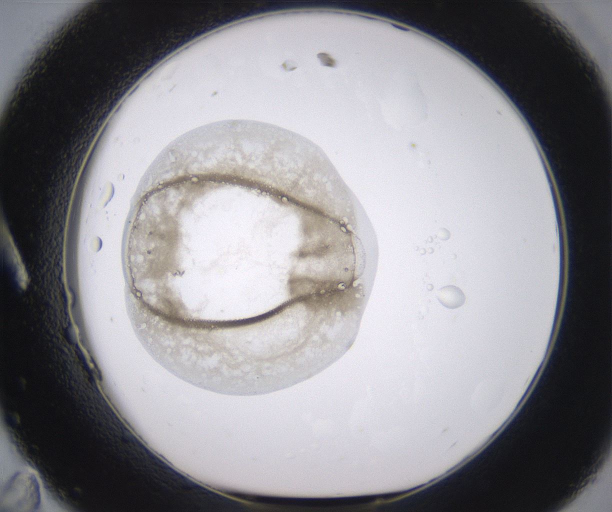 folderID344_plateID2344_batchID11058_wellNum11_profileID1_d1_r165783_ef.jpg
