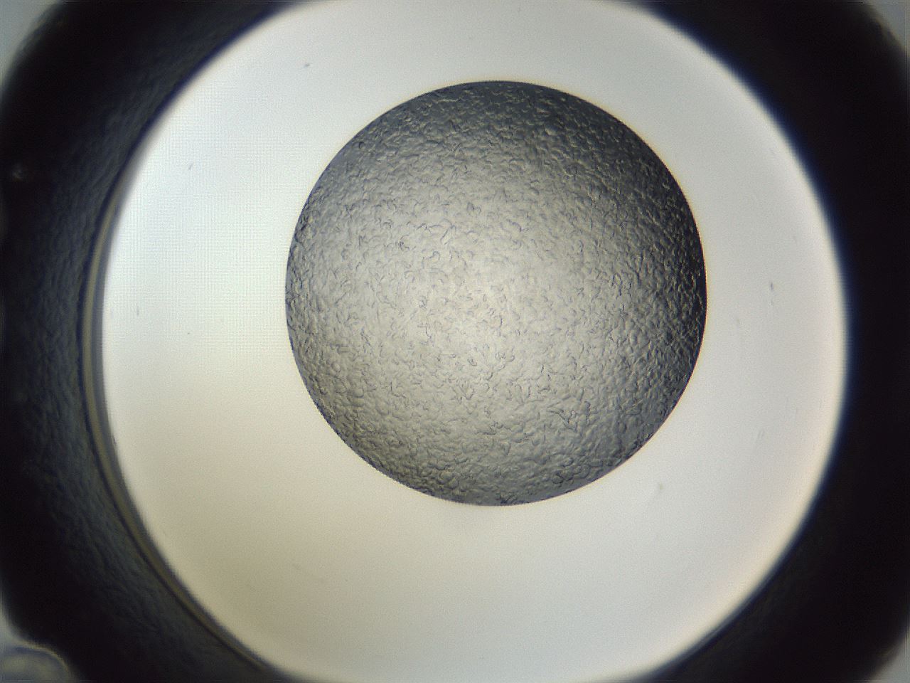 folderID345_plateID1345_batchID4696_wellNum36_profileID1_d1_r81006_ef.jpg