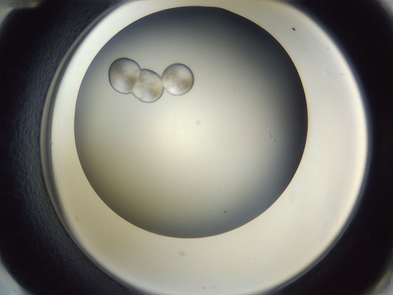folderID345_plateID1345_batchID4696_wellNum60_profileID1_d2_r81055_ef.jpg