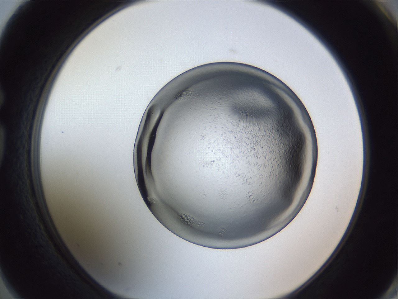 folderID345_plateID1345_batchID4696_wellNum74_profileID1_d1_r81082_ef.jpg