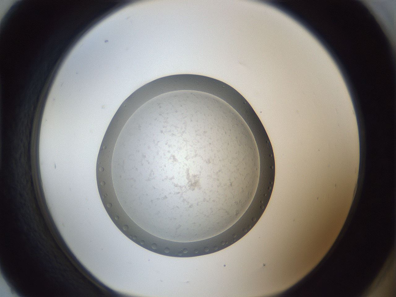 folderID34_plateID1034_batchID2024_wellNum93_profileID1_d1_r45091_ef.jpg