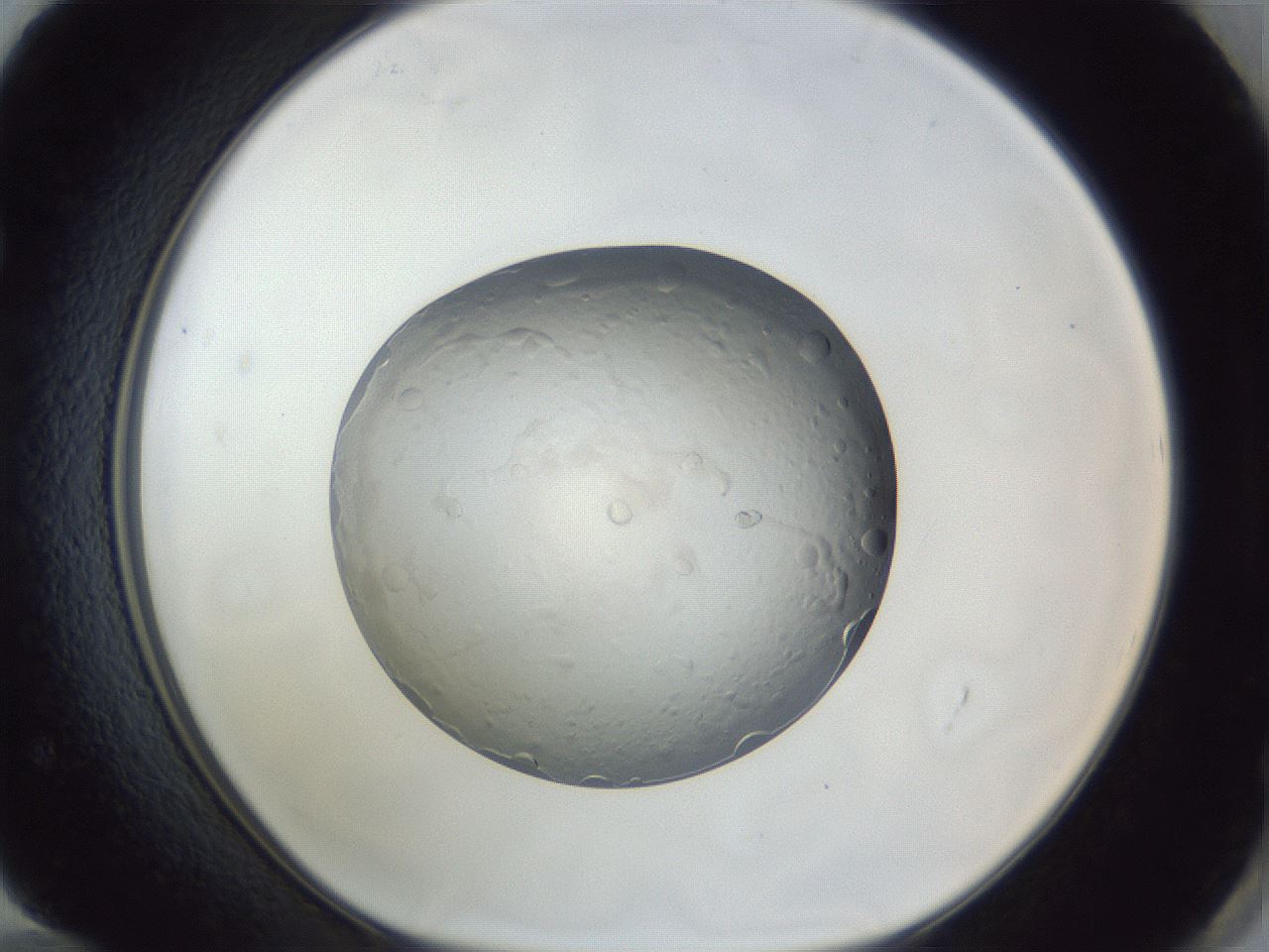 folderID34_plateID1034_batchID2040_wellNum72_profileID1_d1_r45070_ef.jpg