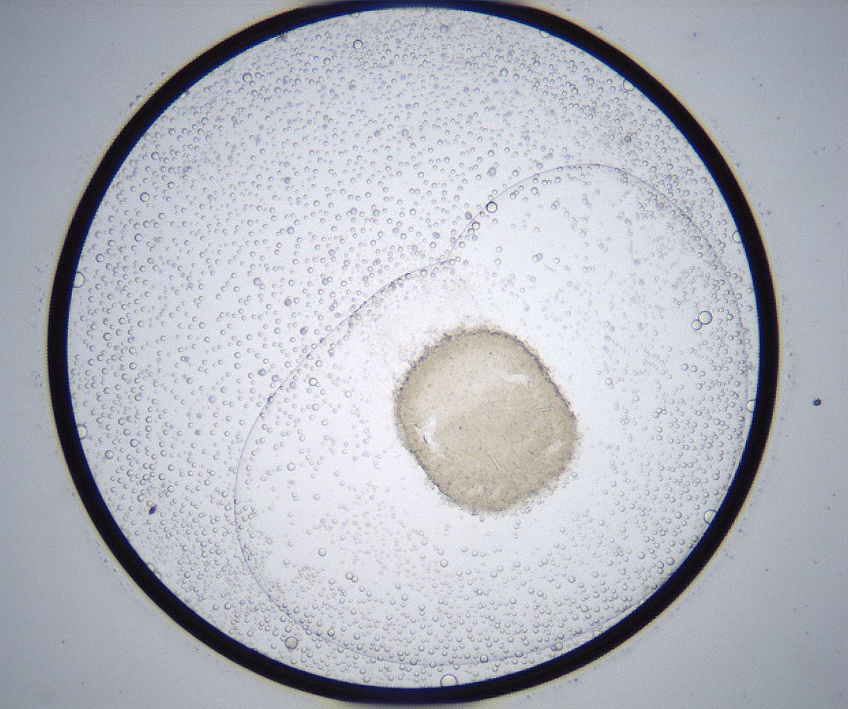 folderID357_plateID2357_batchID11083_wellNum17_profileID1_d1_r167619_ef.jpg