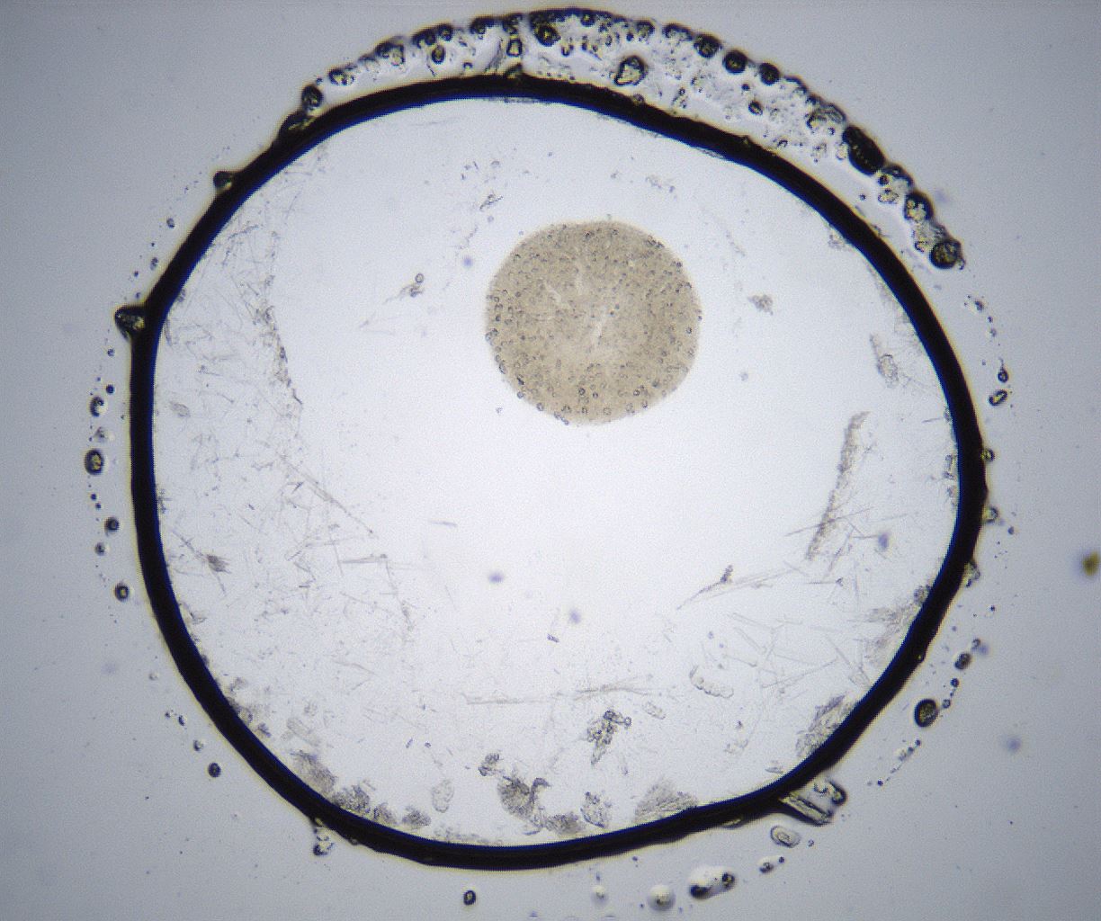 folderID357_plateID2357_batchID11083_wellNum86_profileID1_d1_r167757_ef.jpg
