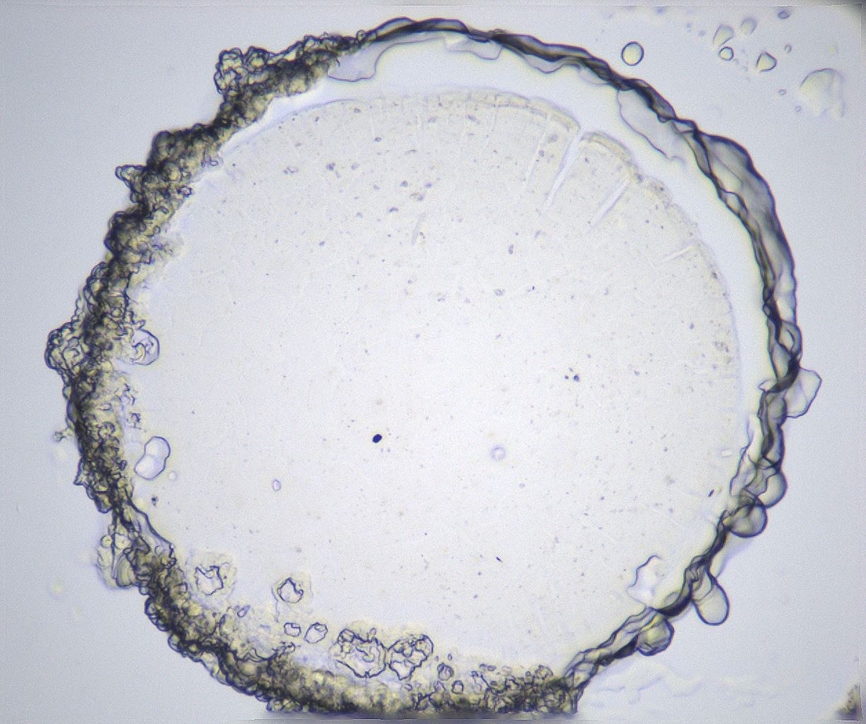 folderID361_plateID2361_batchID11084_wellNum81_profileID1_d1_r167939_ef.jpg