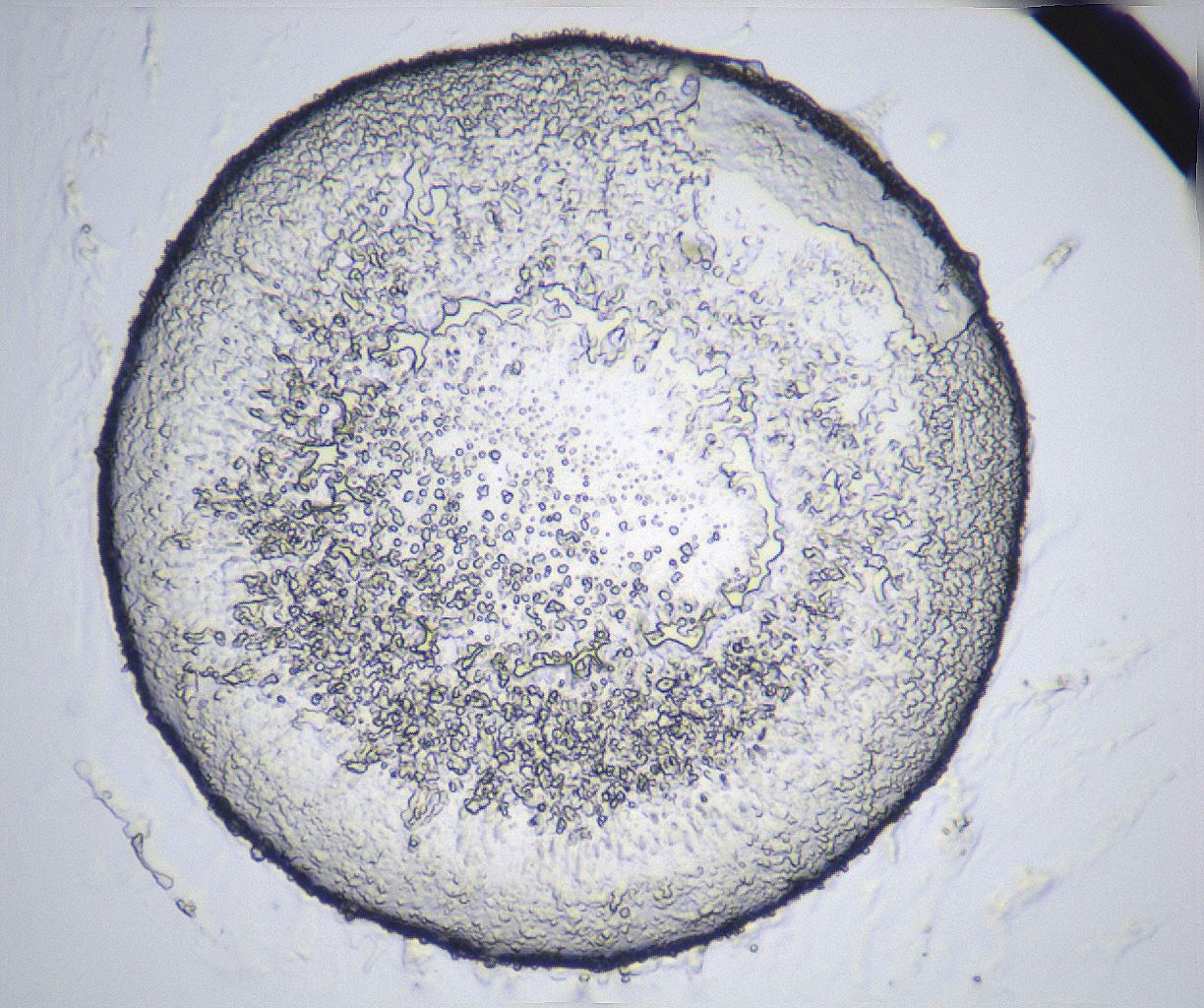 folderID359_plateID2359_batchID11078_wellNum46_profileID1_d1_r167293_ef.jpg
