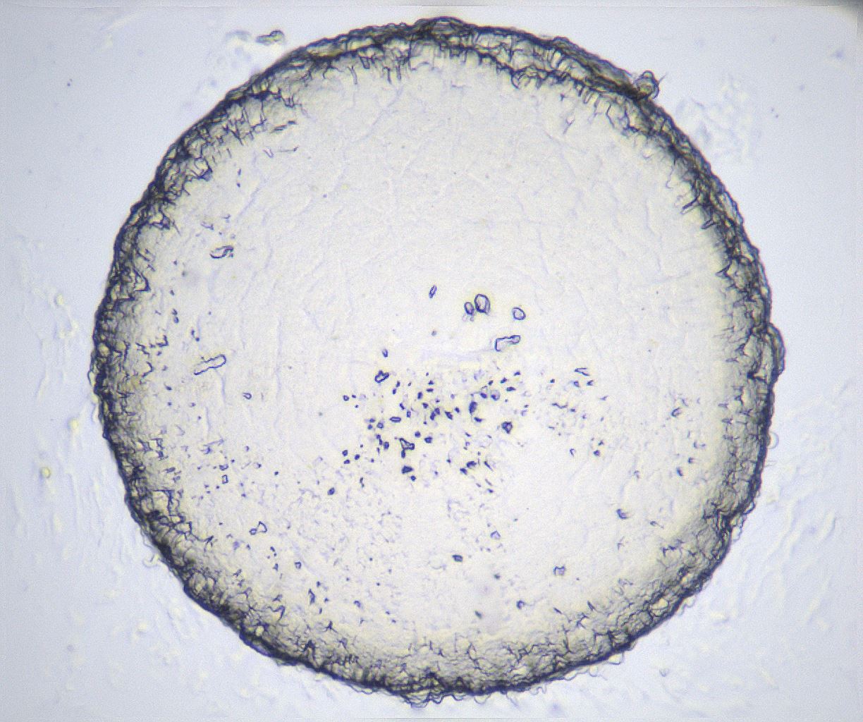 folderID360_plateID2360_batchID11086_wellNum69_profileID1_d1_r168299_ef.jpg