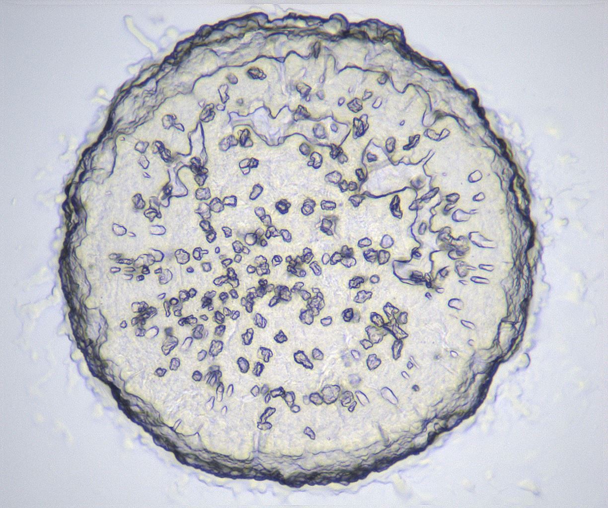 folderID360_plateID2360_batchID11086_wellNum70_profileID1_d1_r168301_ef.jpg