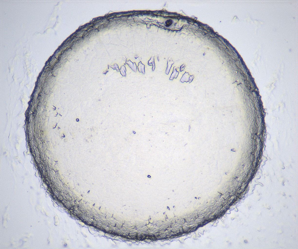 folderID360_plateID2360_batchID11086_wellNum71_profileID1_d1_r168303_ef.jpg