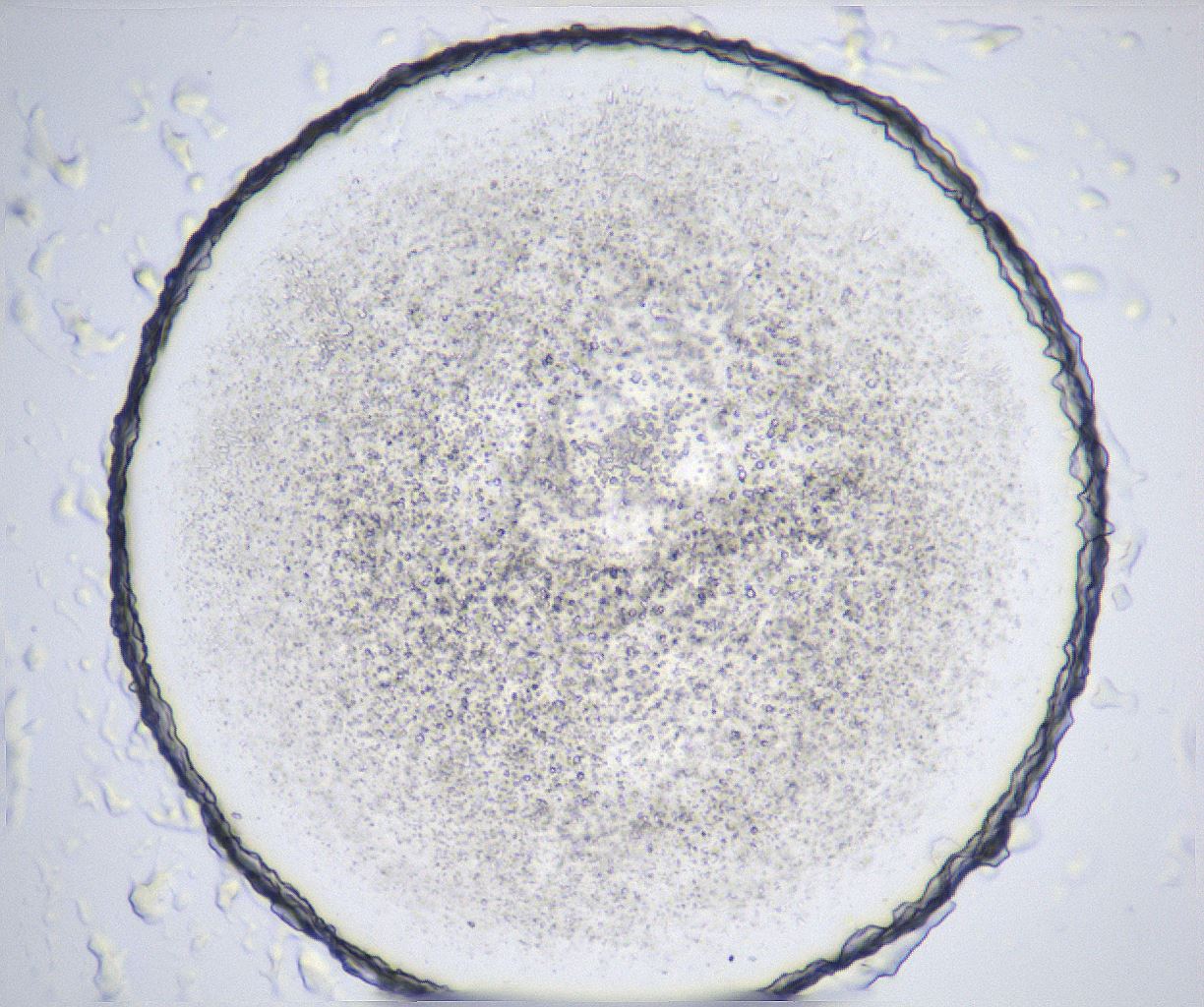 folderID361_plateID2361_batchID11084_wellNum20_profileID1_d1_r167817_ef.jpg