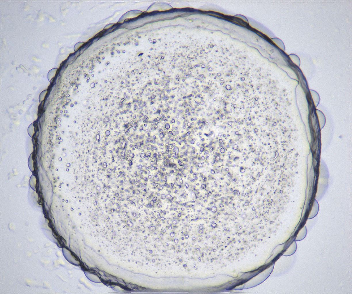 folderID361_plateID2361_batchID11084_wellNum22_profileID1_d1_r167821_ef.jpg