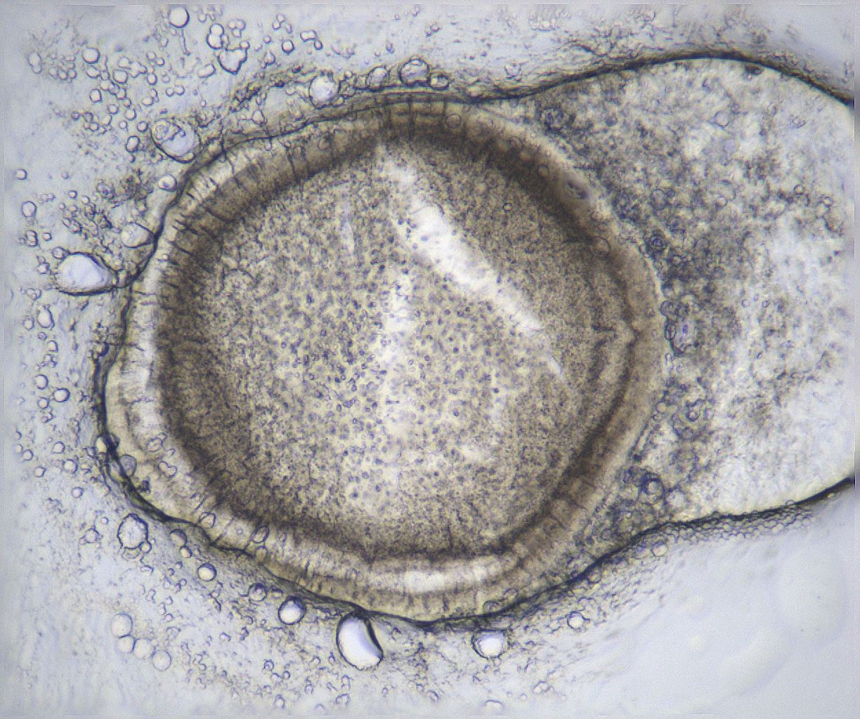 folderID361_plateID2361_batchID11084_wellNum37_profileID1_d1_r167851_ef.jpg