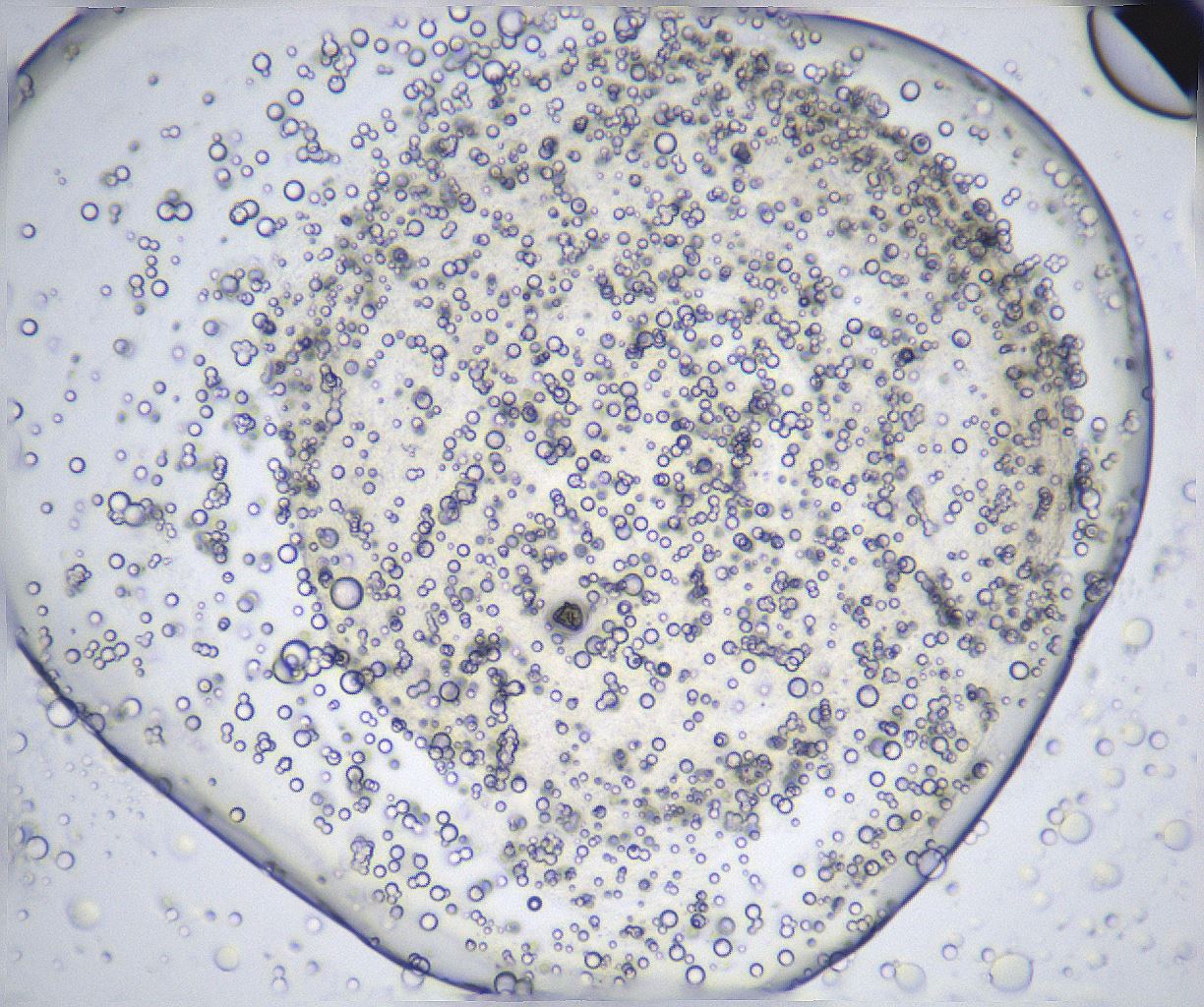 folderID361_plateID2361_batchID11084_wellNum38_profileID1_d1_r167853_ef.jpg