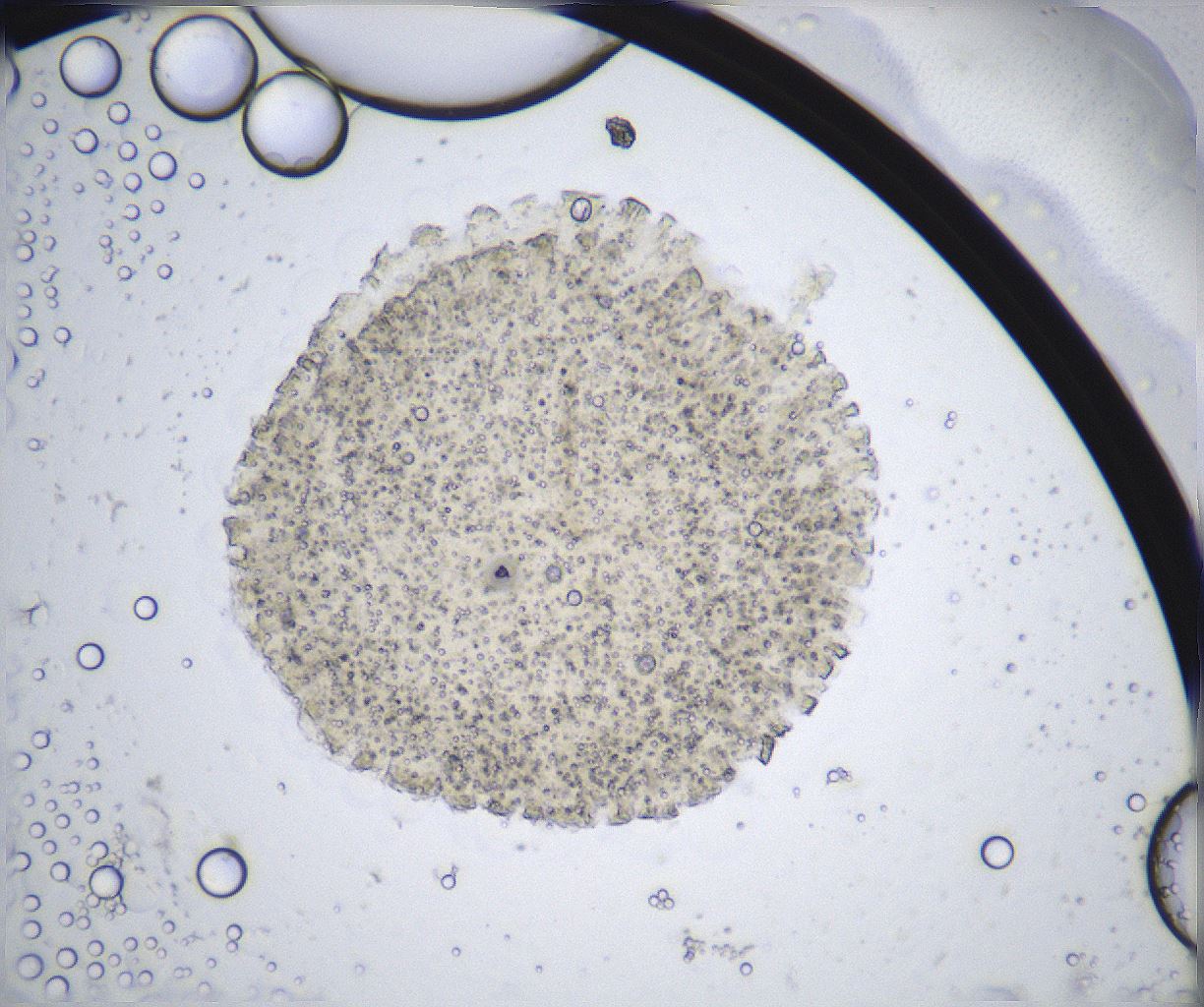 folderID361_plateID2361_batchID11084_wellNum62_profileID1_d1_r167901_ef.jpg