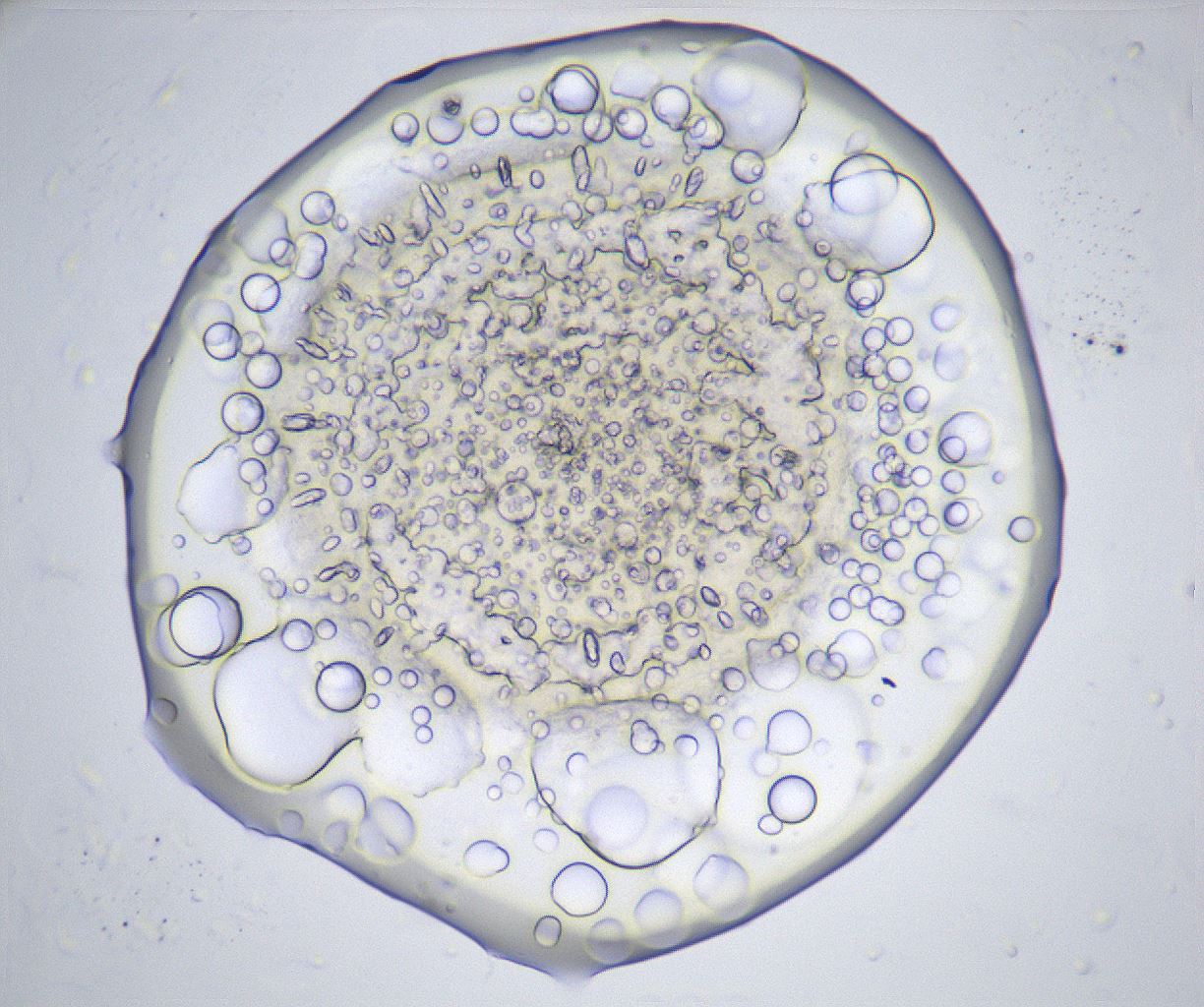 folderID367_plateID2367_batchID11113_wellNum78_profileID1_d1_r170429_ef.jpg