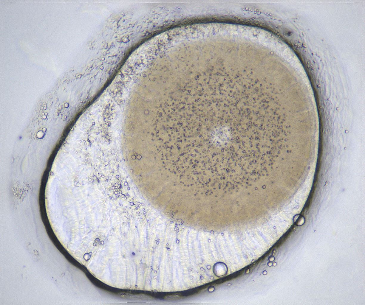 folderID369_plateID2369_batchID11114_wellNum42_profileID1_d1_r170549_ef.jpg