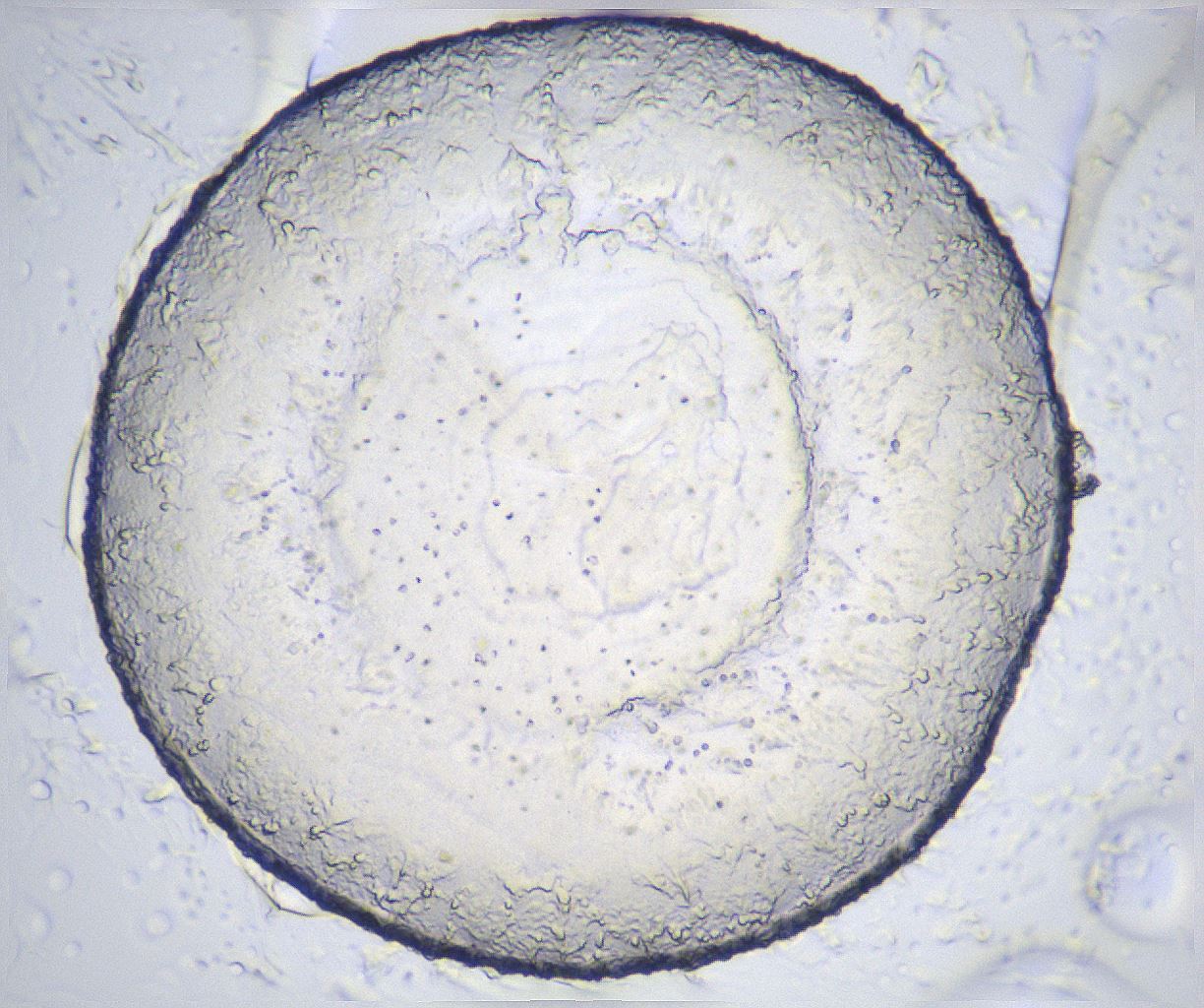 folderID366_plateID2366_batchID11111_wellNum68_profileID1_d1_r170025_ef.jpg