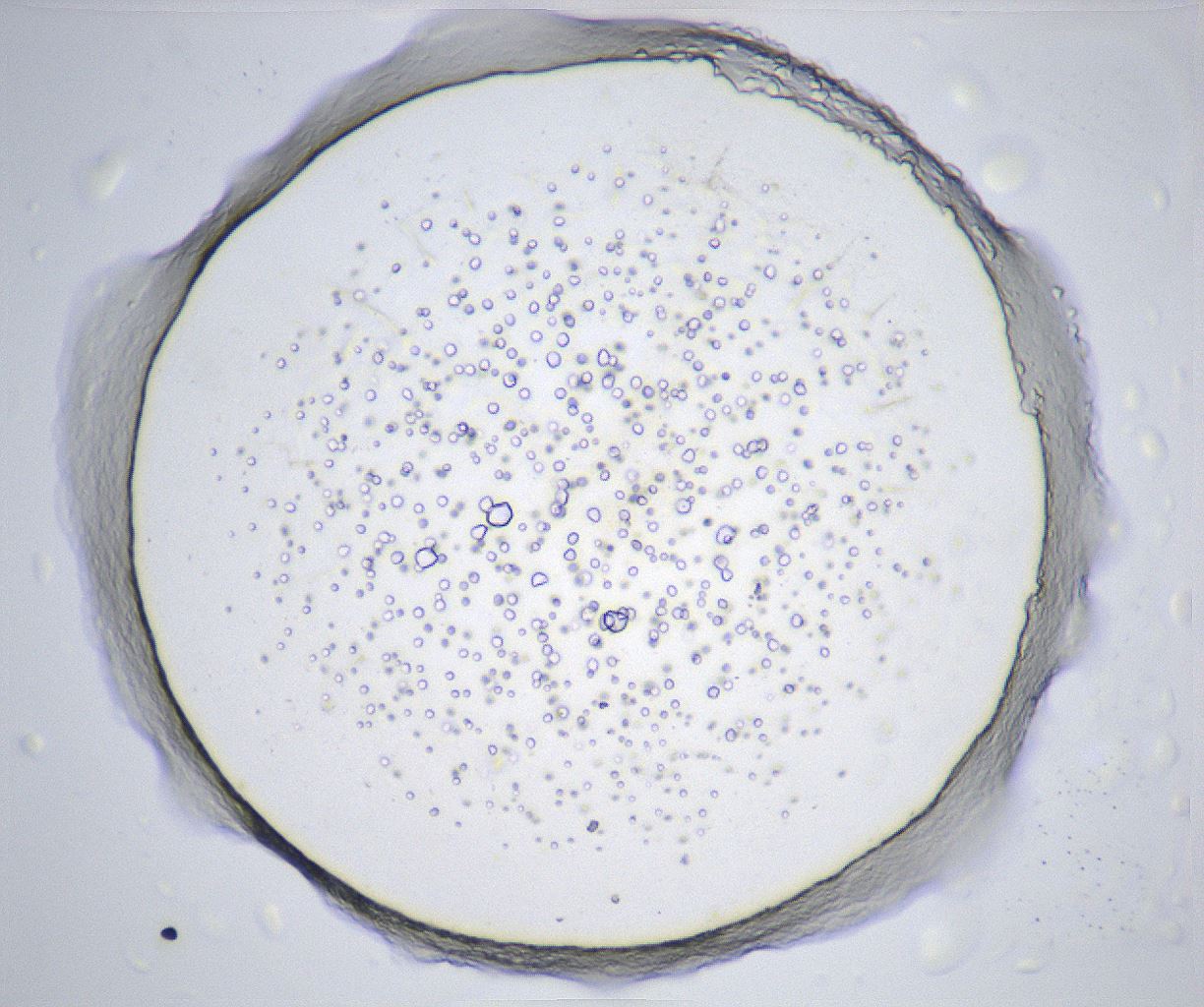 folderID366_plateID2366_batchID11111_wellNum69_profileID1_d1_r170027_ef.jpg