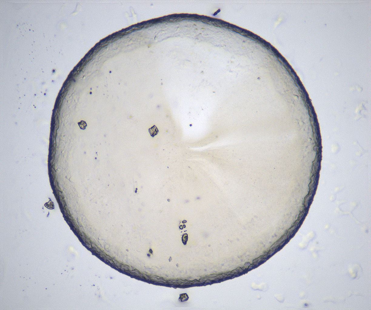 folderID366_plateID2366_batchID11111_wellNum75_profileID1_d1_r170039_ef.jpg