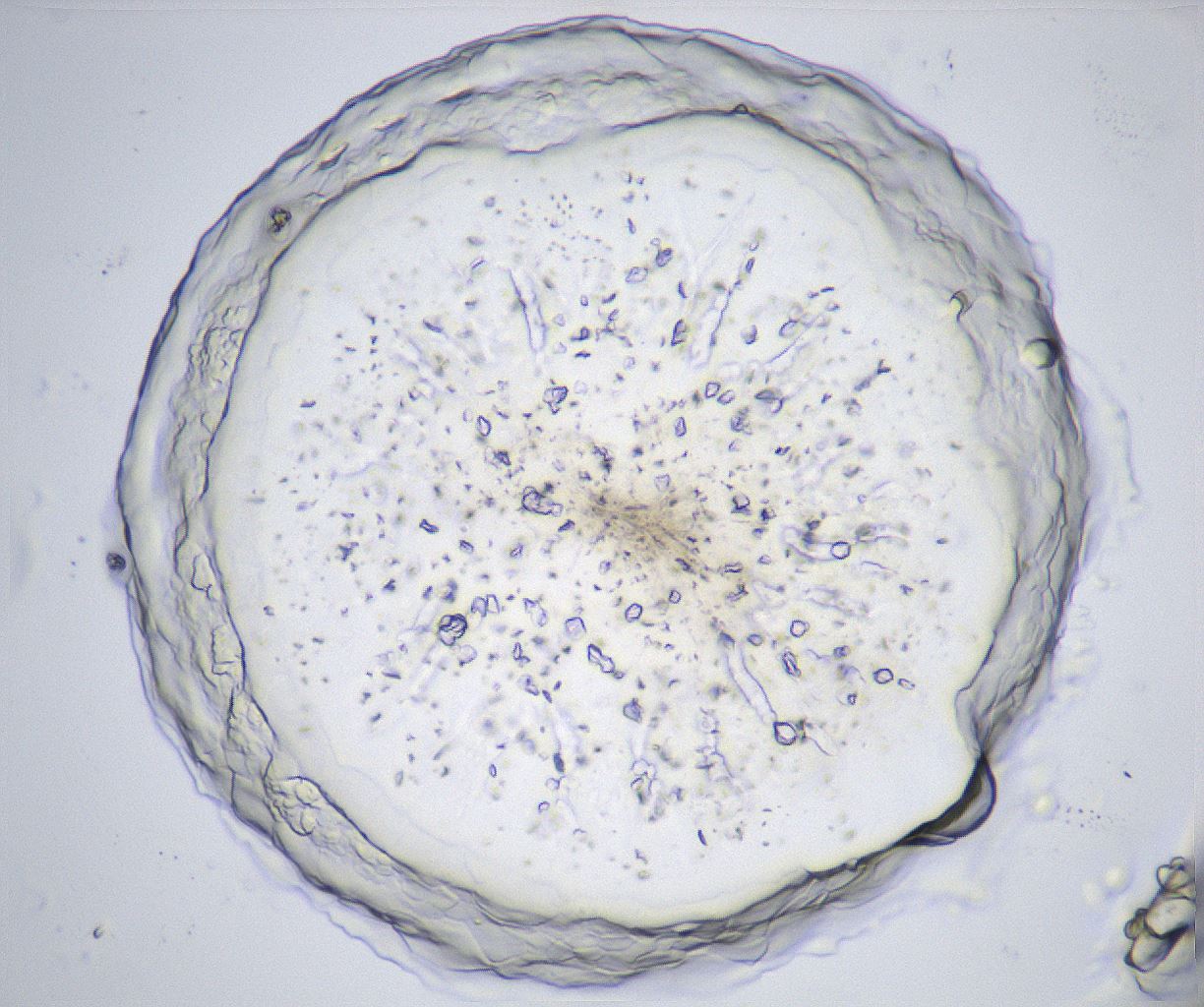 folderID367_plateID2367_batchID11113_wellNum71_profileID1_d1_r170415_ef.jpg
