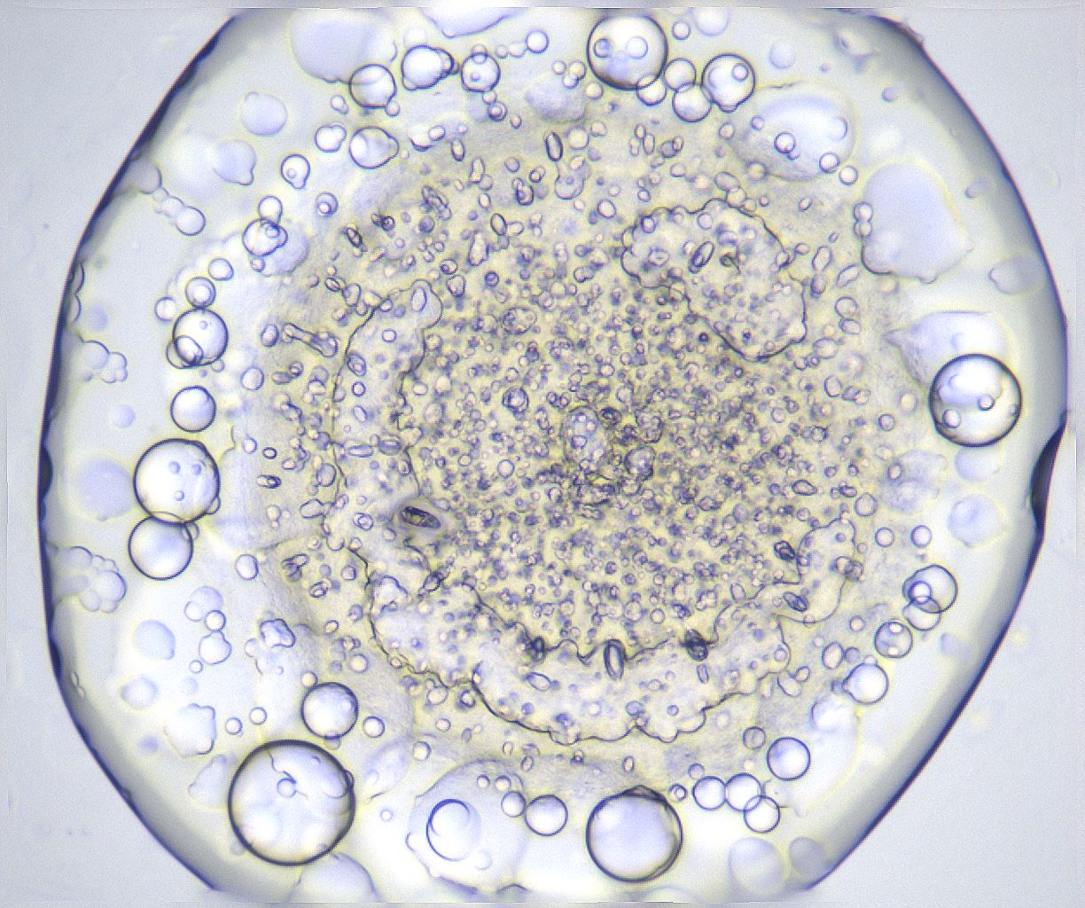 folderID367_plateID2367_batchID11113_wellNum77_profileID1_d1_r170427_ef.jpg