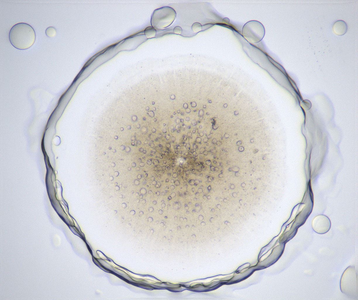 folderID369_plateID2369_batchID11114_wellNum53_profileID1_d1_r170571_ef.jpg