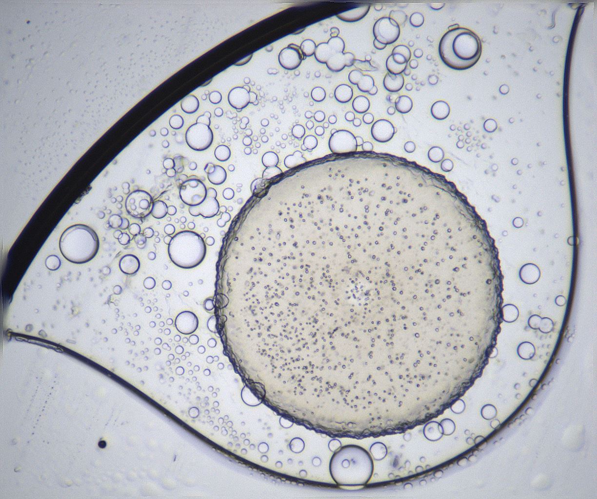 folderID369_plateID2369_batchID11114_wellNum55_profileID1_d1_r170575_ef.jpg