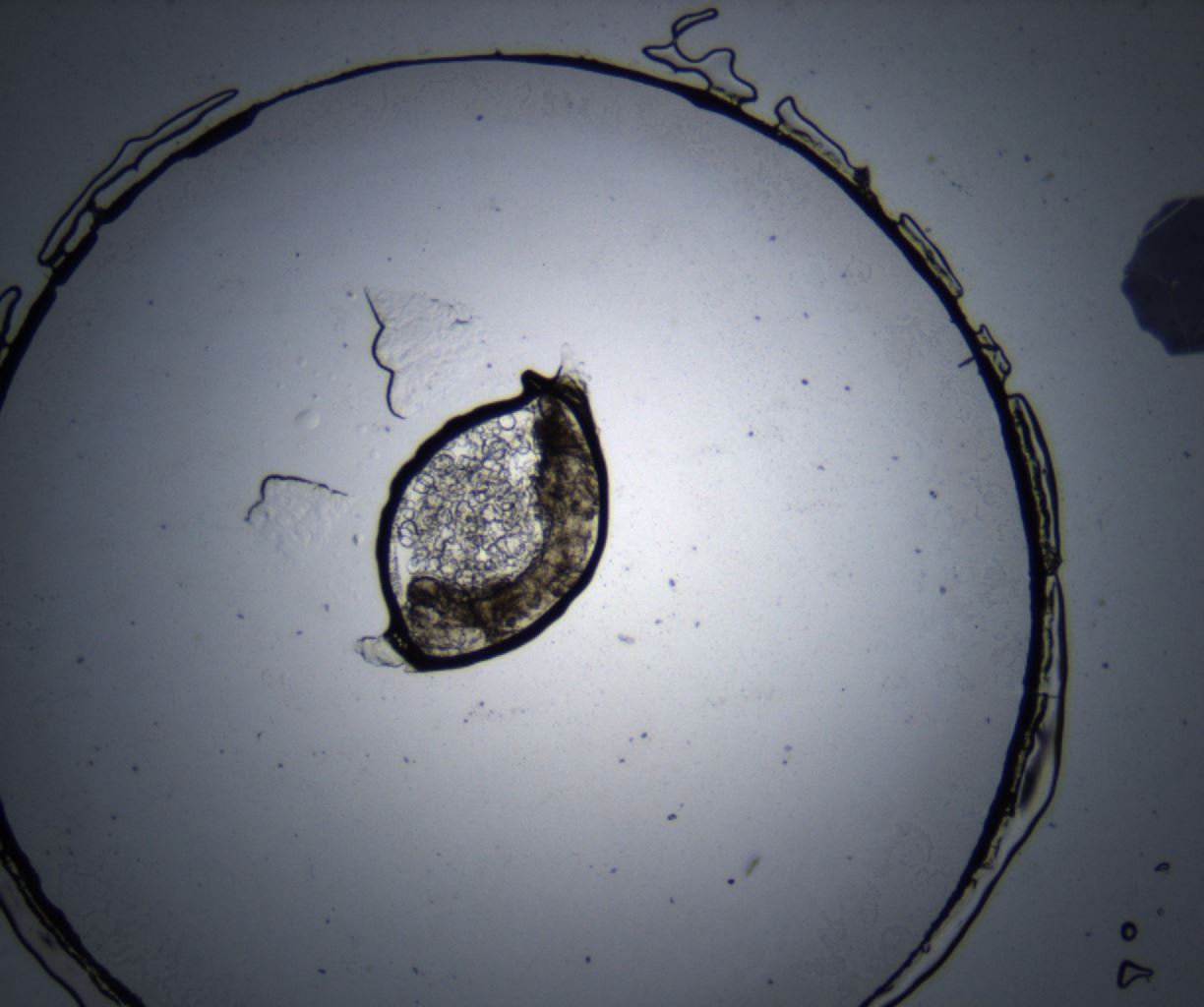 folderID371_plateID2371_batchID11115_wellNum29_profileID1_d1_r170716_ef.jpg