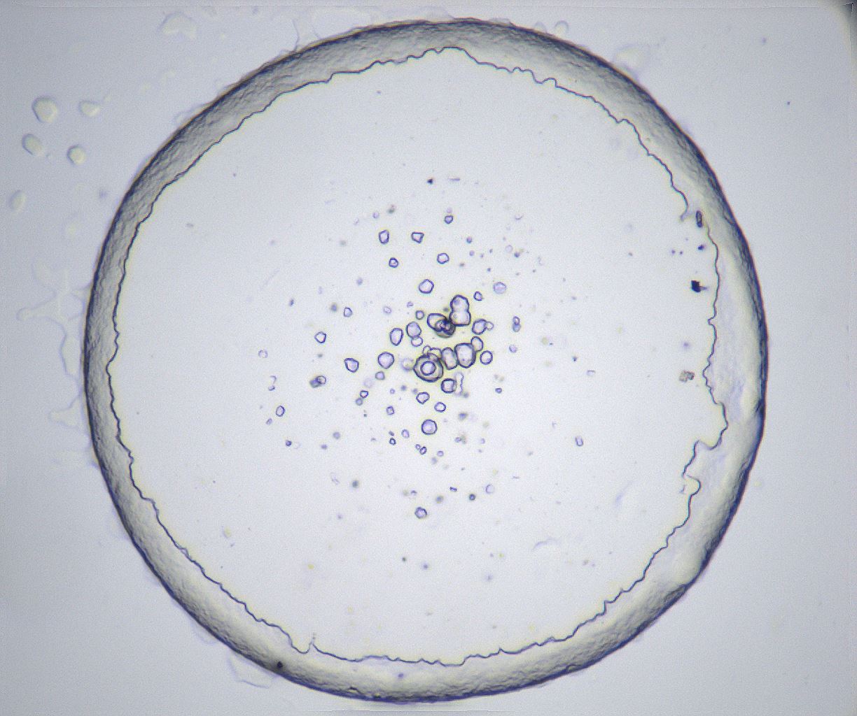 folderID371_plateID2371_batchID11115_wellNum32_profileID1_d1_r170721_ef.jpg