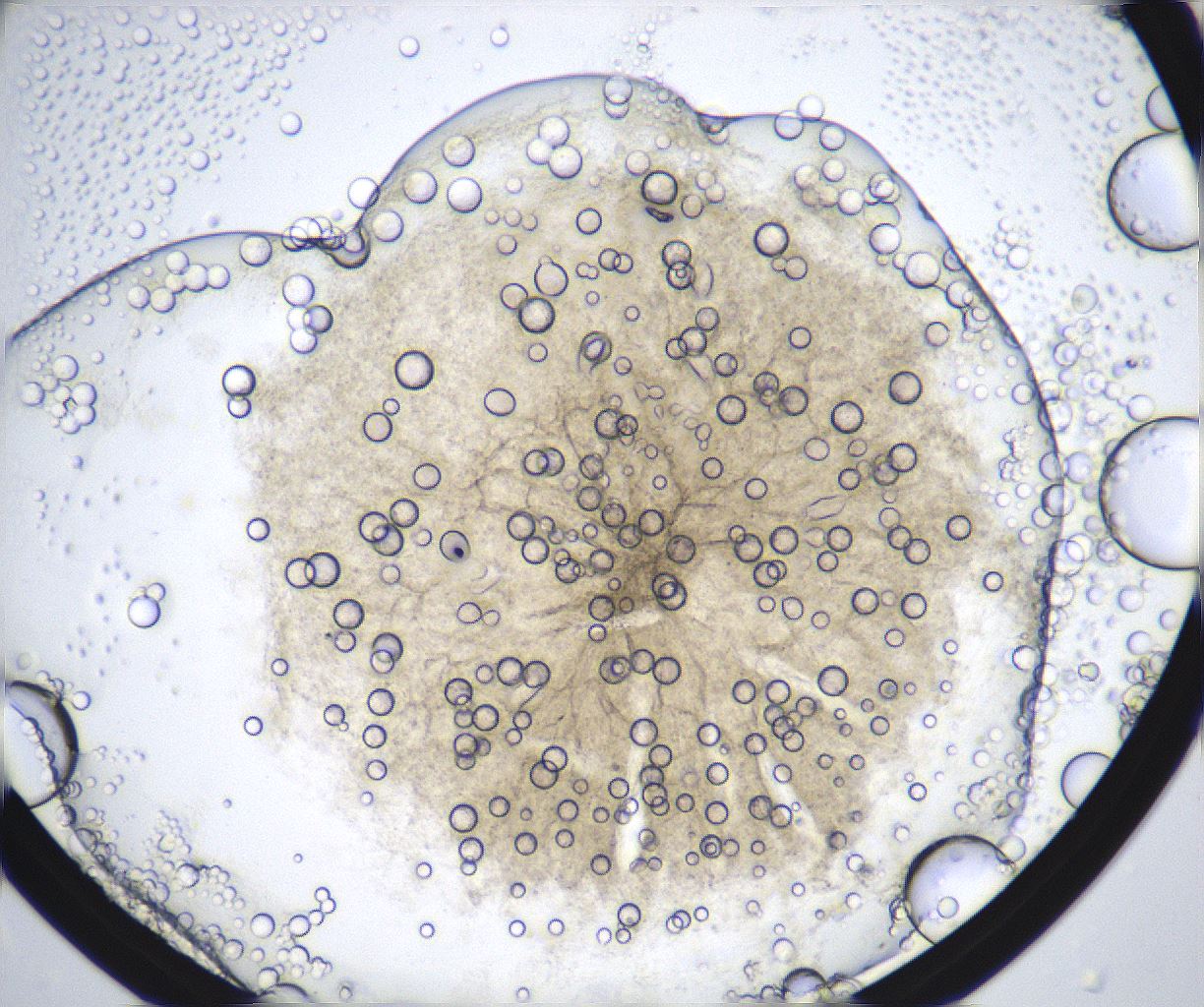 folderID371_plateID2371_batchID11115_wellNum3_profileID1_d1_r170663_ef.jpg