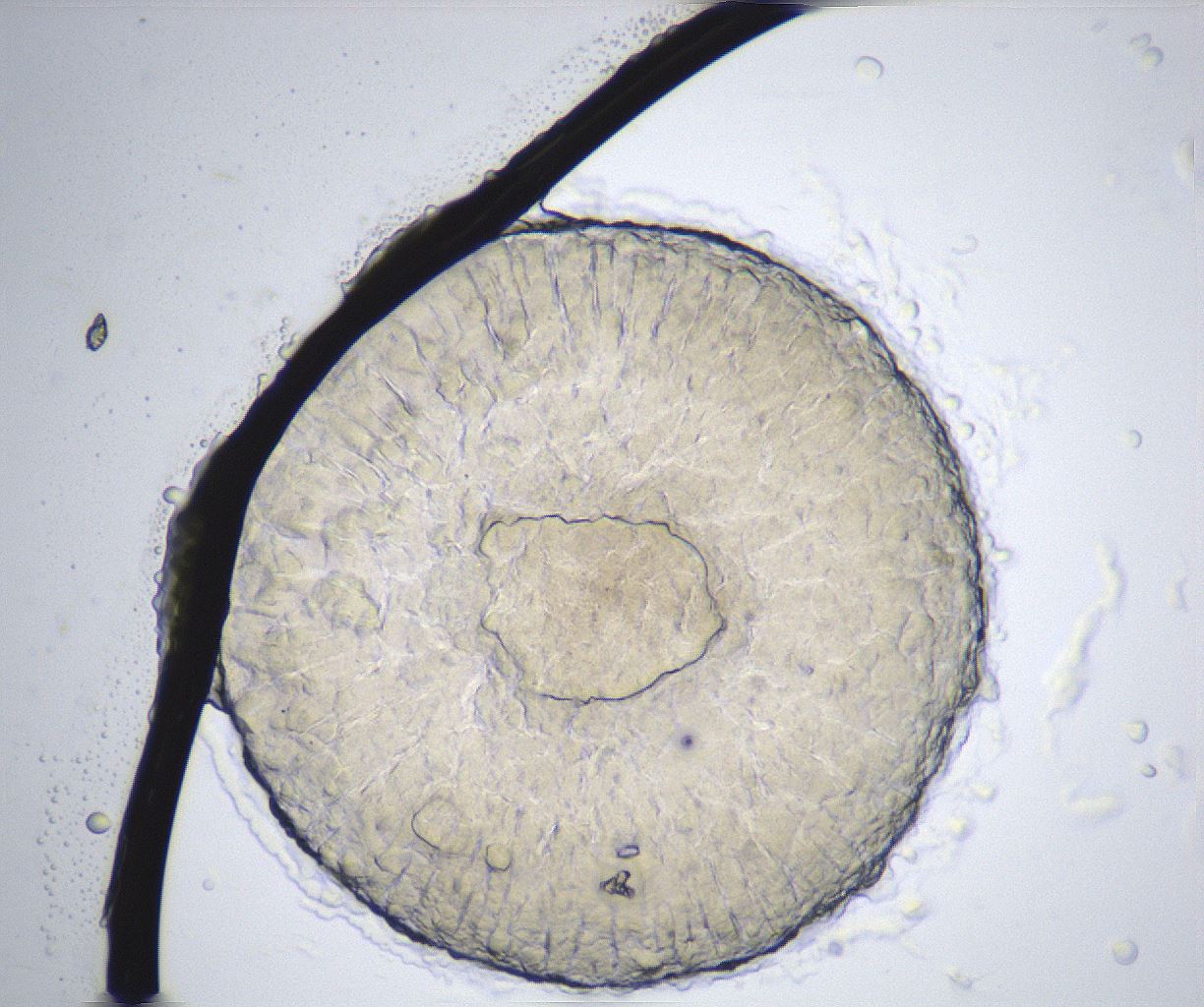 folderID371_plateID2371_batchID11115_wellNum56_profileID1_d1_r170769_ef.jpg