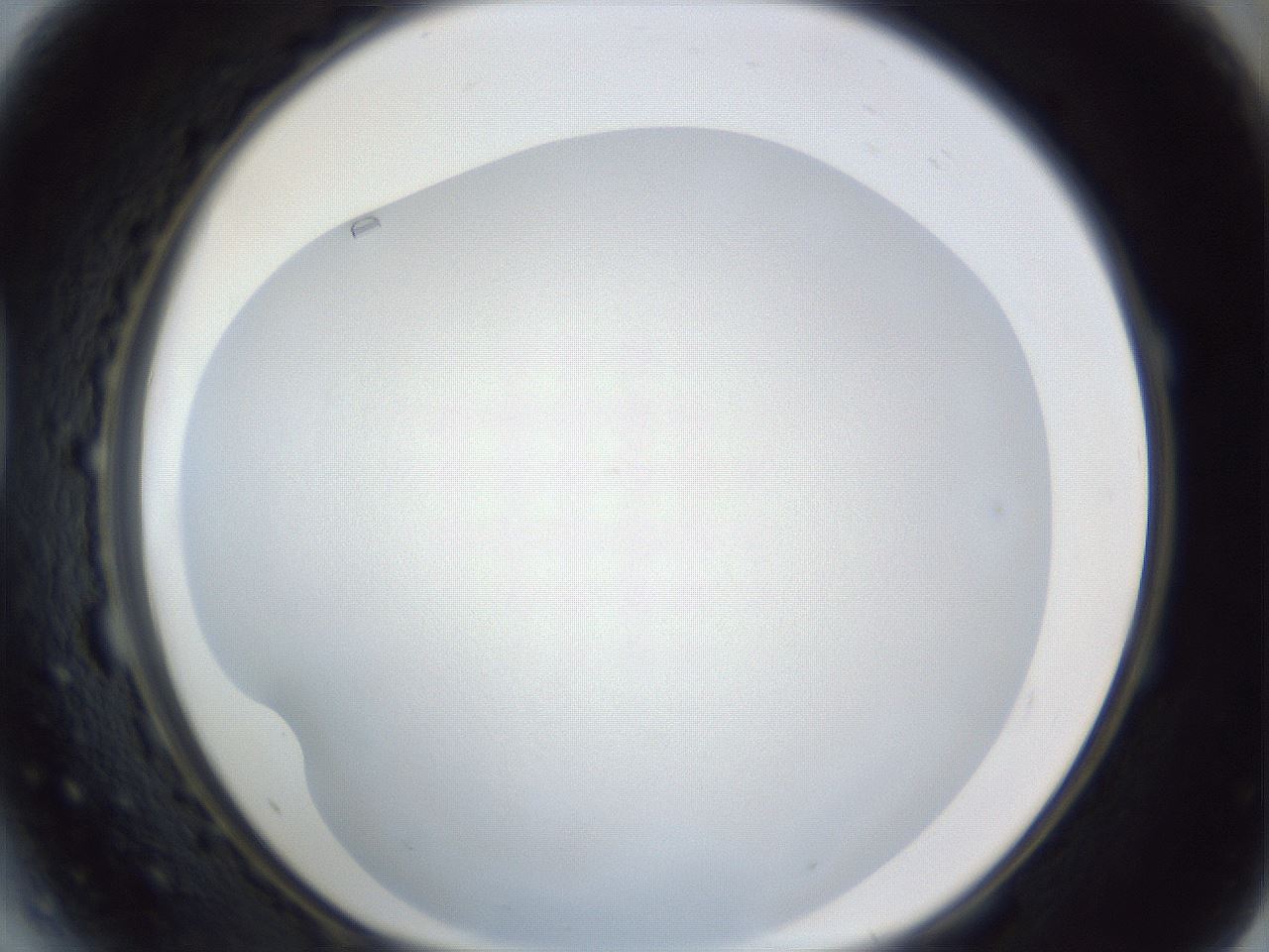 folderID383_plateID1383_batchID4985_wellNum41_profileID1_d1_r84536_ef.jpg