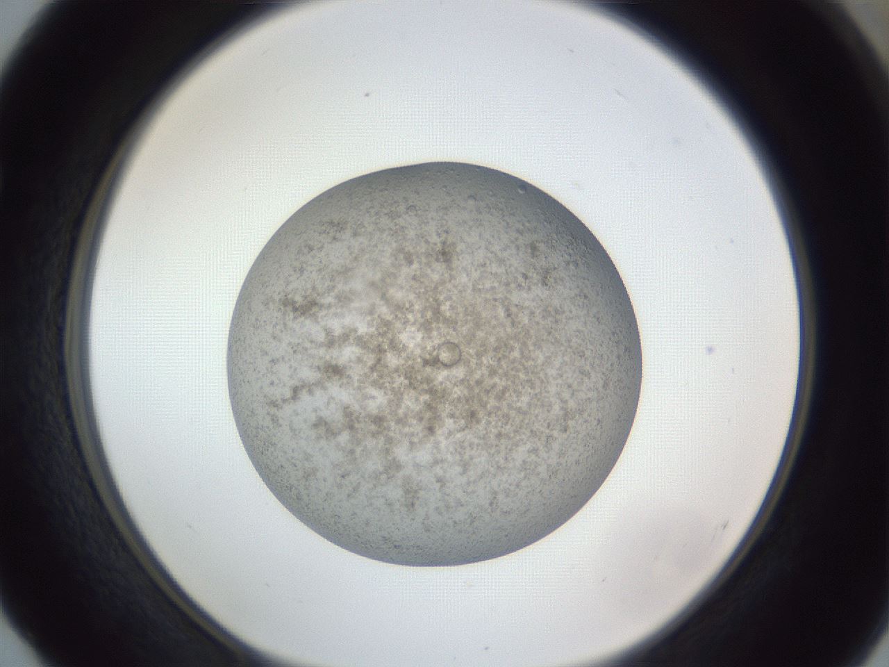 folderID384_plateID1384_batchID4986_wellNum52_profileID1_d1_r84643_ef.jpg