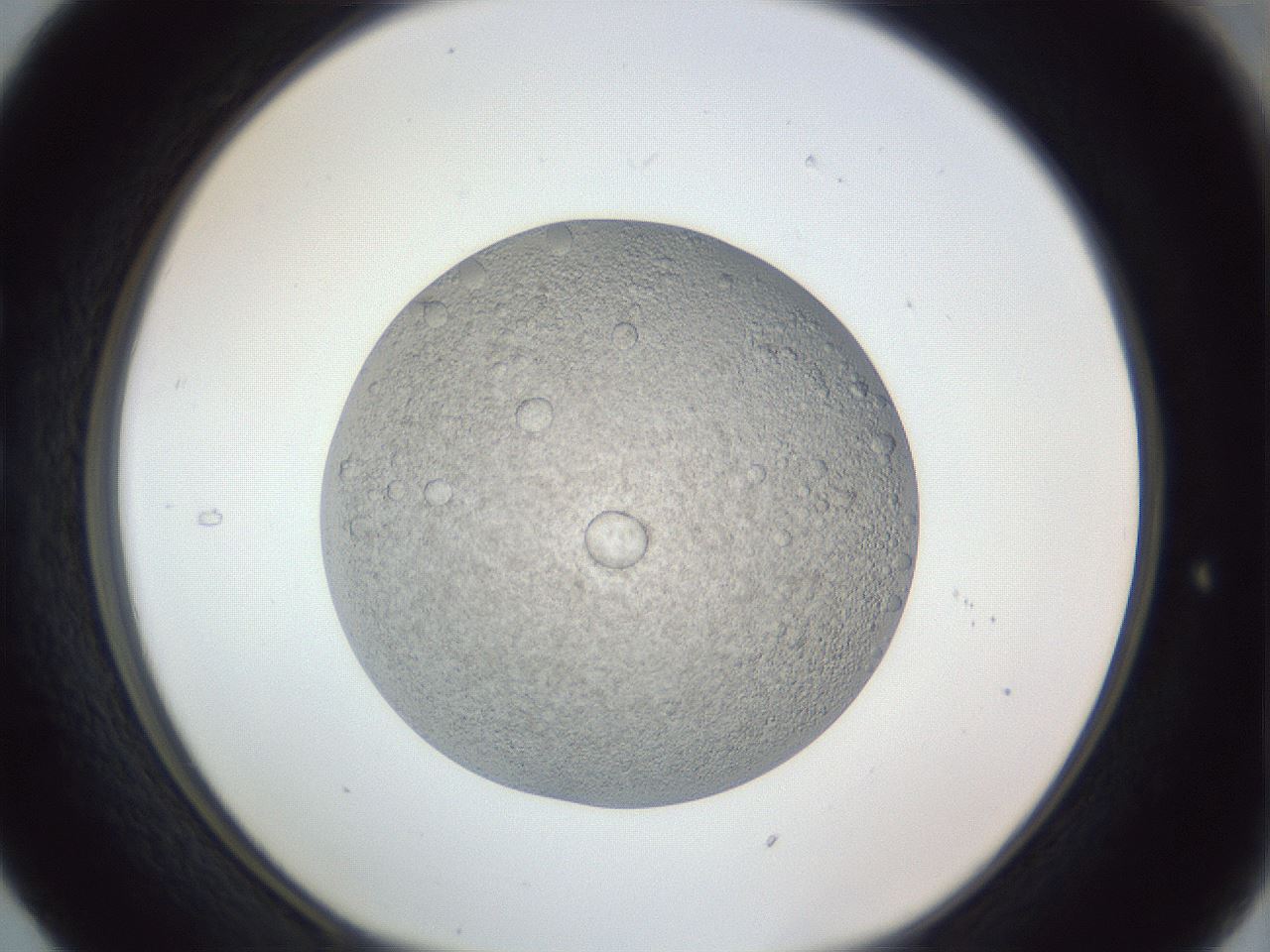 folderID385_plateID1385_batchID4987_wellNum29_profileID1_d1_r84716_ef.jpg