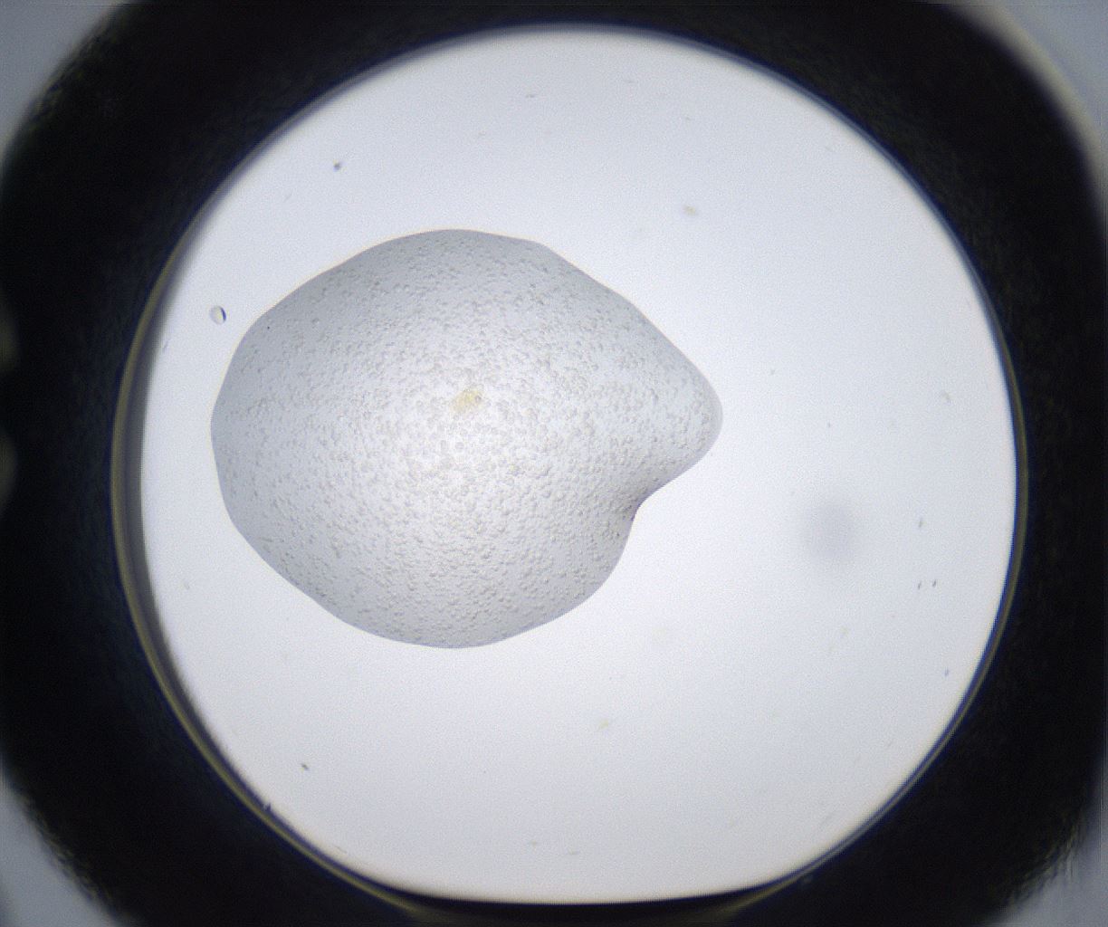 folderID377_plateID2377_batchID11227_wellNum33_profileID1_d1_r175683_ef.jpg