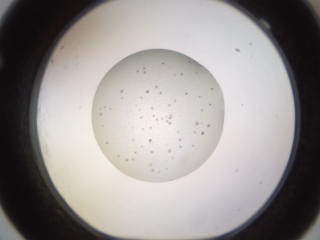 folderID398_plateID1398_batchID5055_wellNum69_profileID1_d1_r85430_ef.jpg