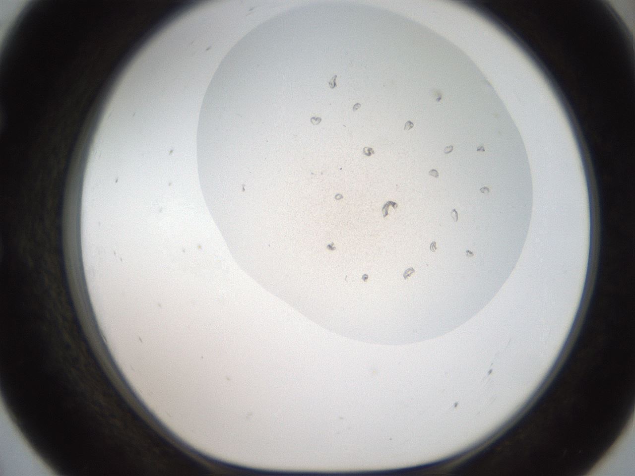 folderID401_plateID2401_batchID11542_wellNum55_profileID1_d1_r177679_ef.jpg