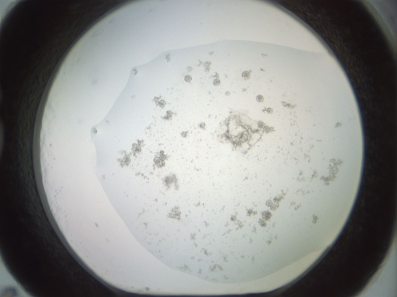 folderID402_plateID2402_batchID11611_wellNum83_profileID1_d1_r177927_ef.jpg