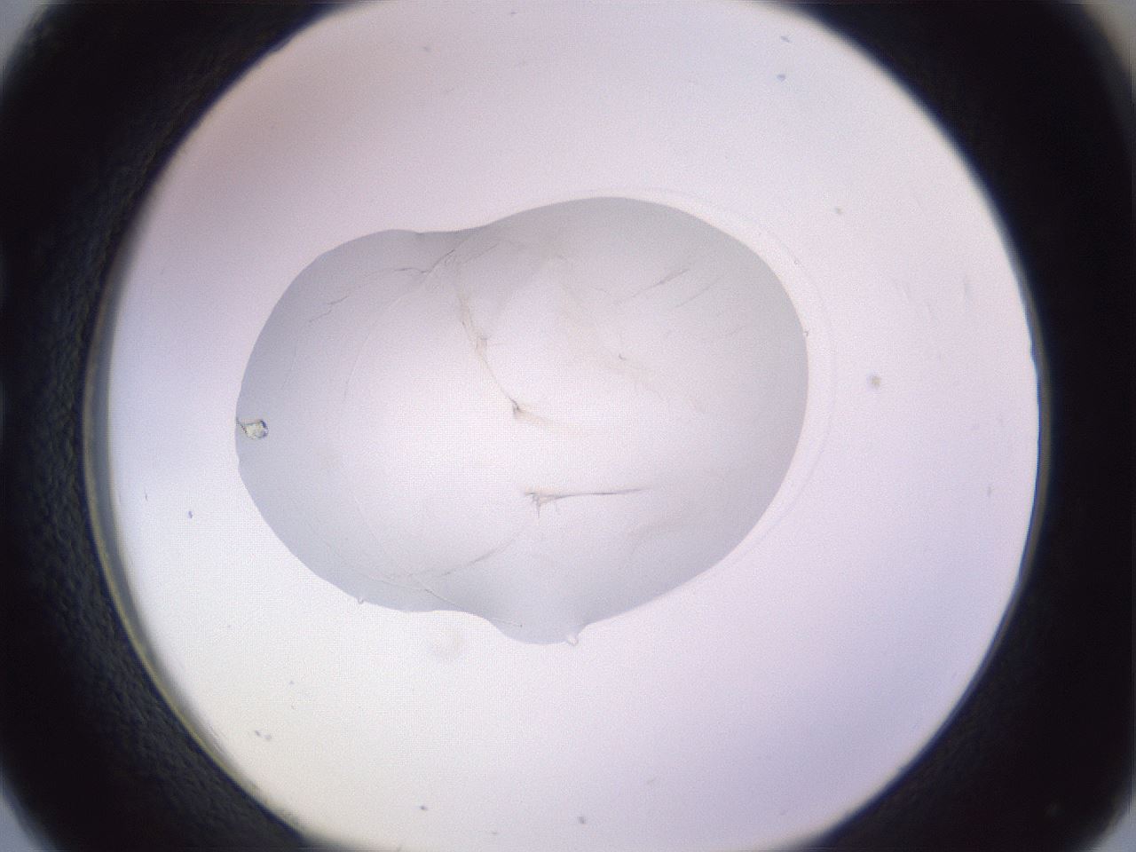 folderID416_plateID1416_batchID5191_wellNum26_profileID1_d1_r86827_ef.jpg